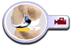 Uniknee Replacement Adelaide